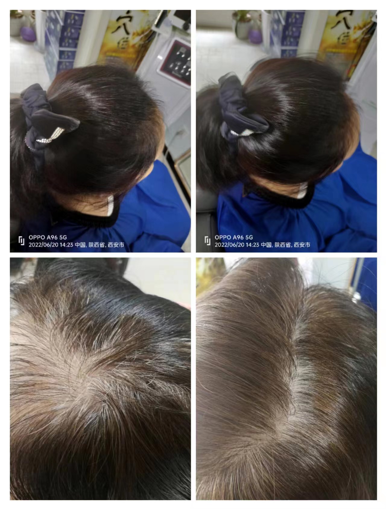 秀丝顿植物养发不但是修复受损的发干，同时是把毛囊头皮等从里到外的根本上修复。