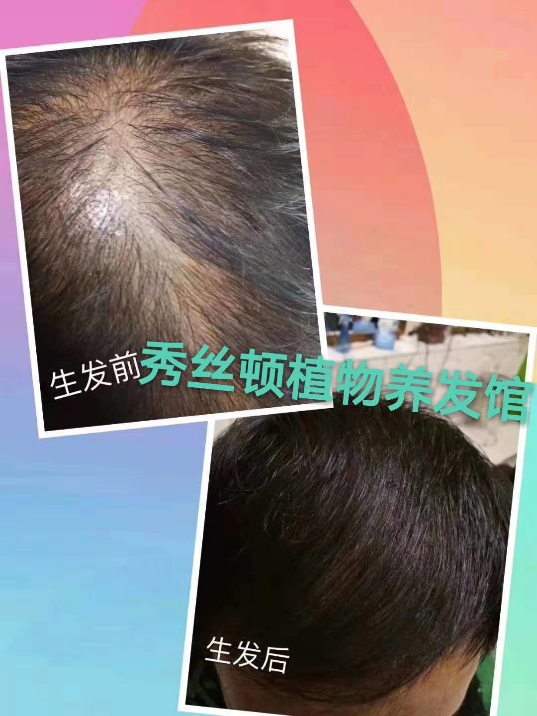 秀丝顿植物染发采用纯天然植物成分，不含有任何化学添加剂，对头发无伤害