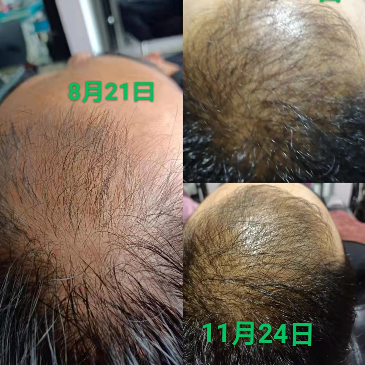 秀丝顿植物养发专业专注保养头发