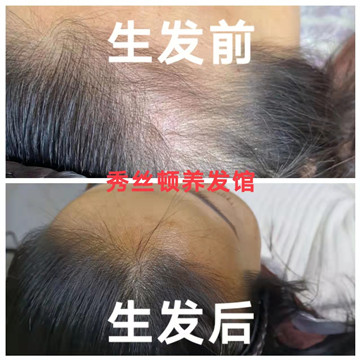 秀丝顿植物养发馆 头部理疗就是在头部反射区按摩头部