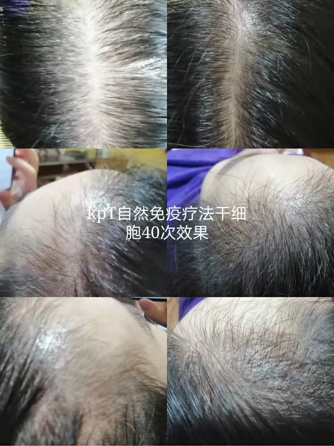 秀丝顿植物养发头疗应用传统中医手法疏通经络，刮痧，按摩可以起到一下保健作用