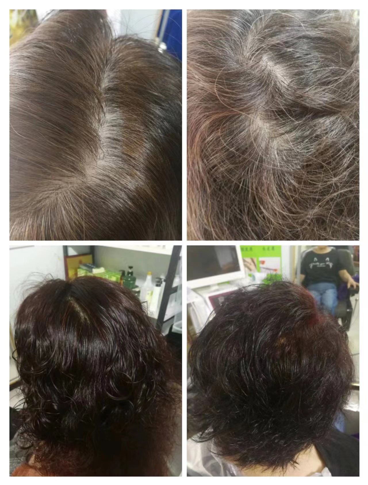秀丝顿植物养发防脱育发，不仅能帮助你解决头发问题，还能让你散发出自信与美丽