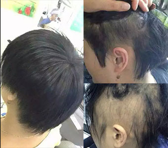 秀丝顿植物染发是一种全新的染发方式，它使用天然的植物材料来染发。这种染发方式不仅安全无伤害