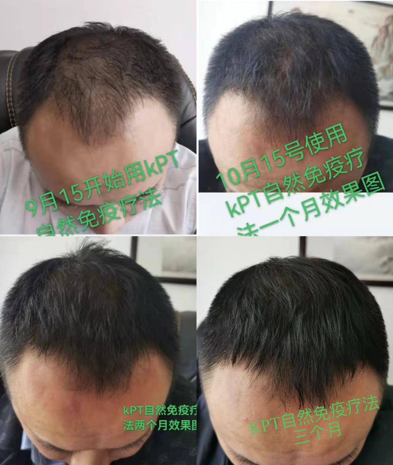 秀丝顿植物养发防脱育发，采用天然植物成分，针对头发问题进行根源性解决。