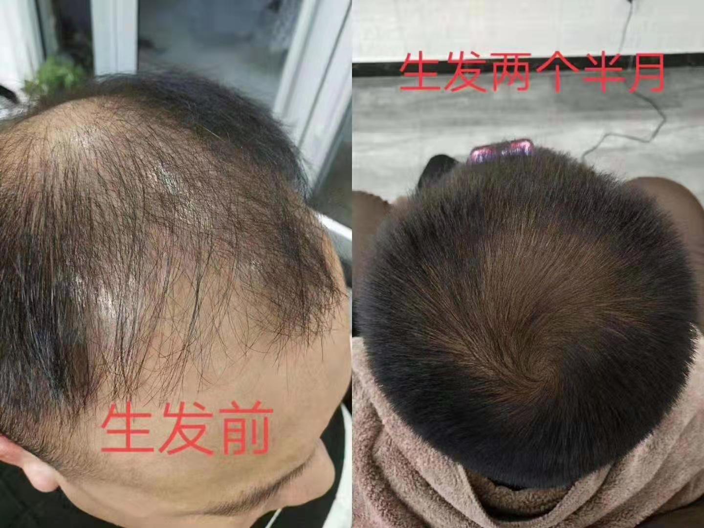 秀丝顿植物养发健康时尚是一种以天然植物为主要成分的头发染发方法