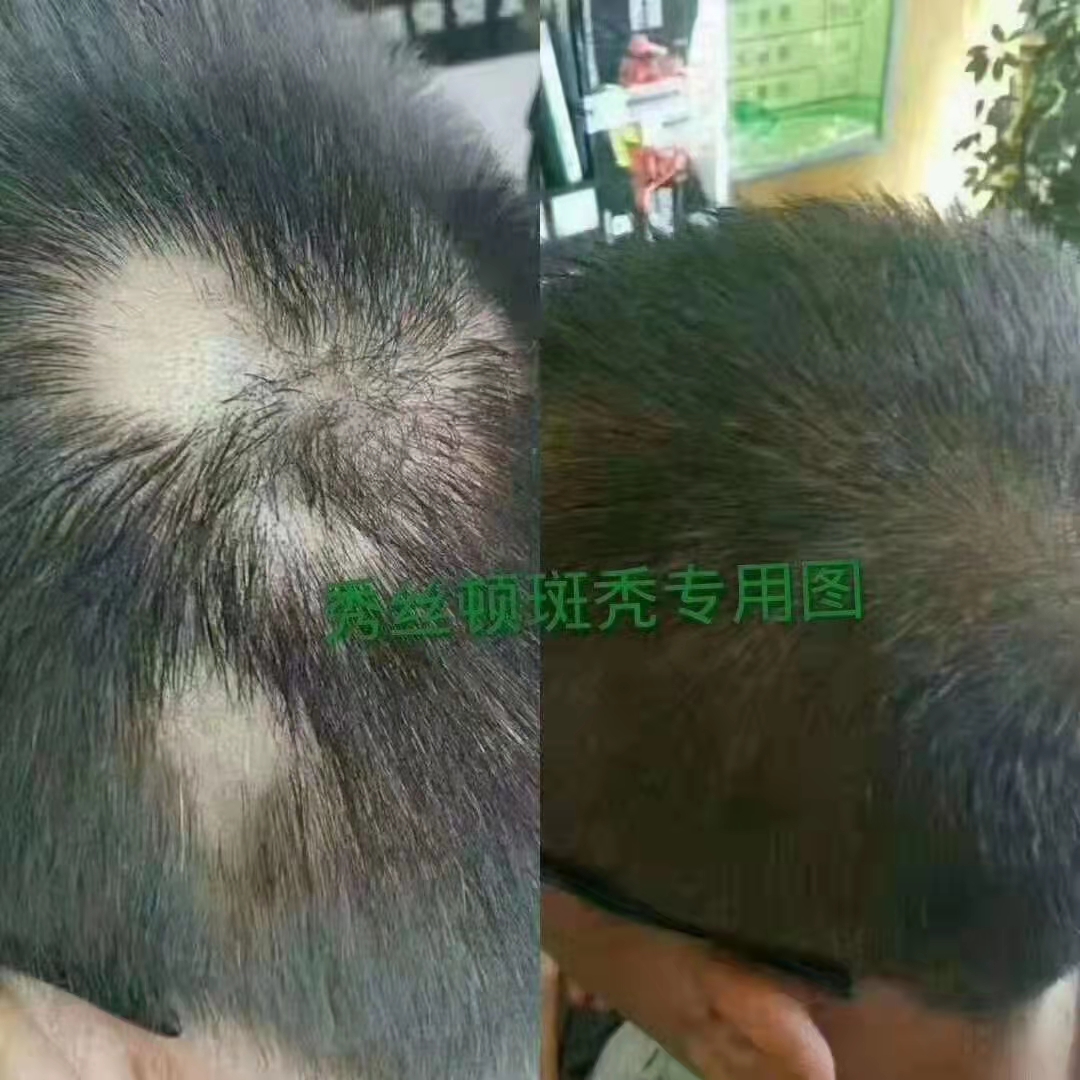 秀丝顿植物染发健康时尚是一种以天然植物为主要成分的头发染发方法